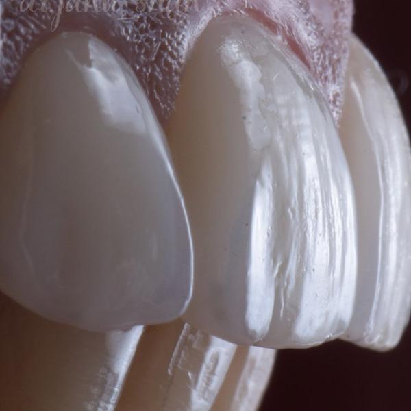 Blog Images