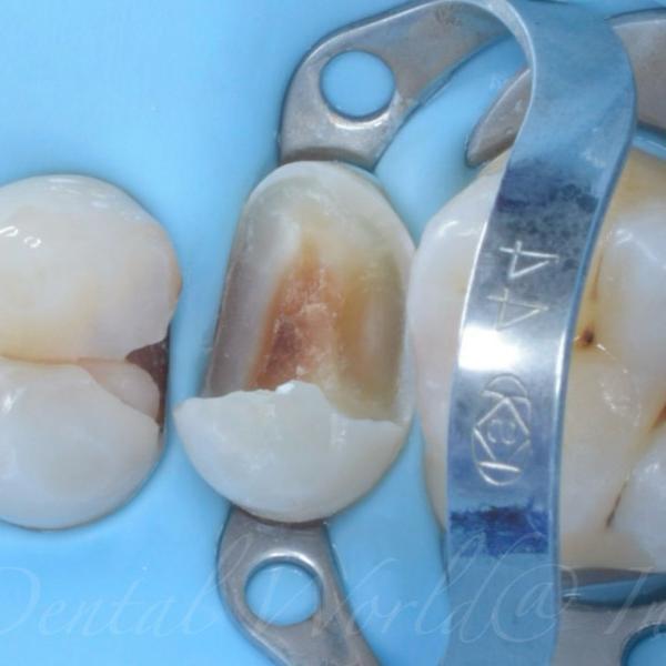 Blog Images
