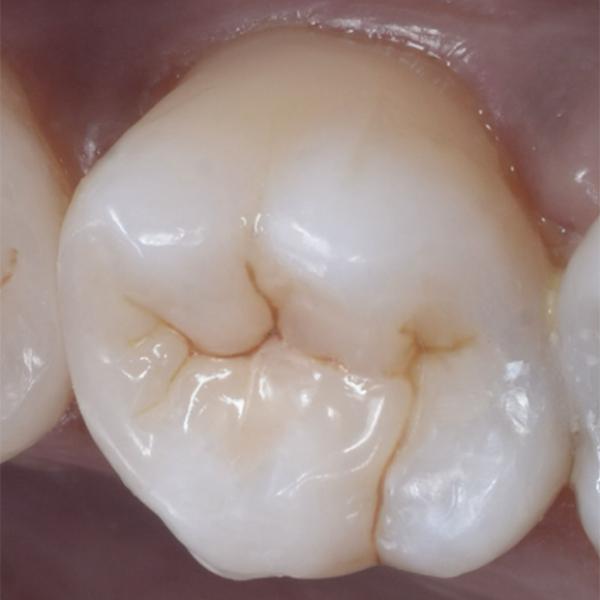Blog Images